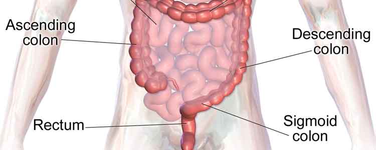 natural remedies for Natural Remedies for diverticulitis