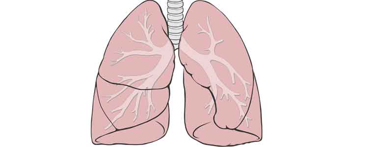 home remedies for bronchitis