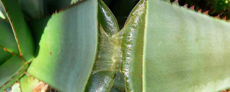 aloe vera natural remedy for hives