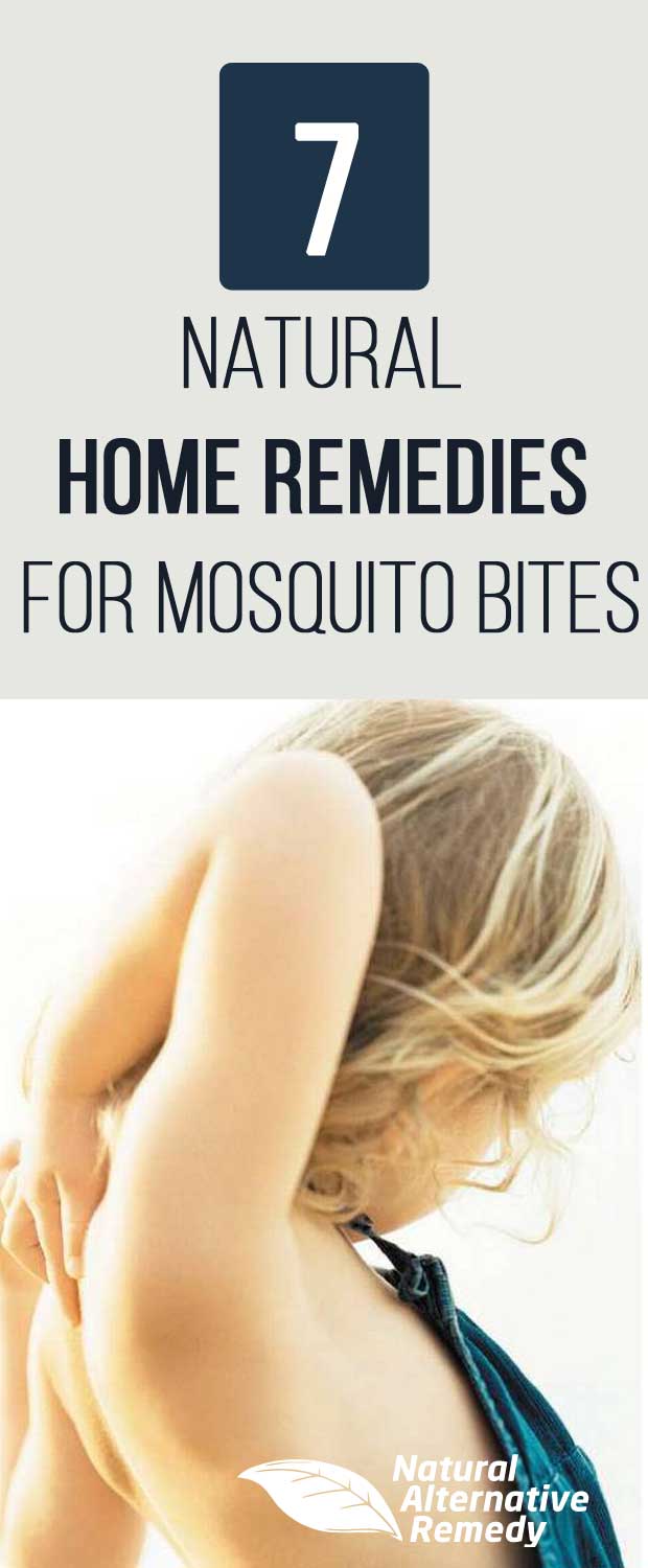 Ditch the itch with these 7 natural home remedies for mosquito bites (that really work!). #homeremedies #ditchtheitch | NaturalAlternativeRemedy.com
